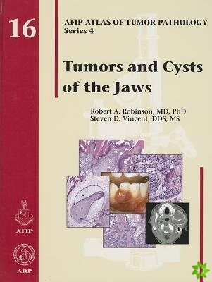 Tumors and Cysts of the Jaws