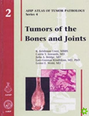Tumors of the Bones and Joints