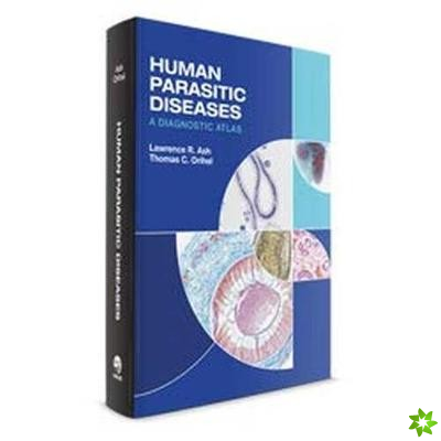 Human Parasitic Diseases