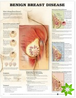 Benign Breast Disease Anatomical Chart