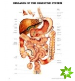 Diseases of the Digestive System Anatomical Chart