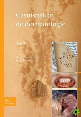 Casuistiek in de Dermatologie - Deel 2
