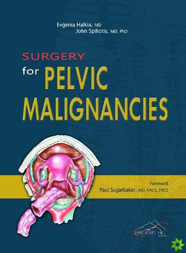Surgery for Pelvic Malignancies