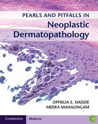 Pearls and Pitfalls in Neoplastic Dermatopathology with Online Access