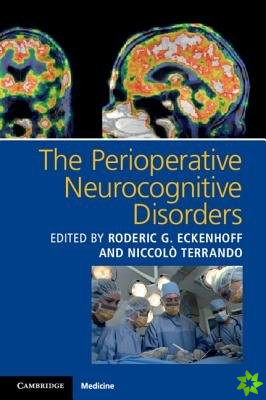 Perioperative Neurocognitive Disorders