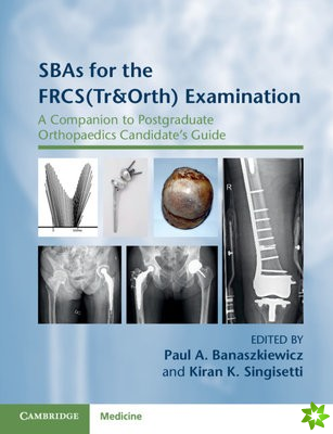 SBAs for the FRCS(Tr&Orth) Examination