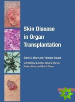 Skin Disease in Organ Transplantation