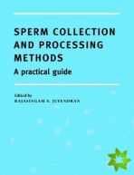 Sperm Collection and Processing Methods