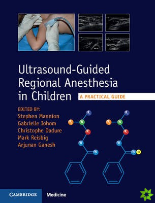 Ultrasound-Guided Regional Anesthesia in Children