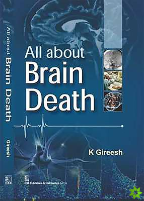 All About Brain Death
