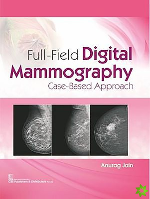 Full-Field Digital Mammography