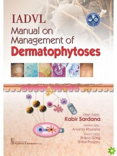 IADVL Manual on Management of Dermatophytoses