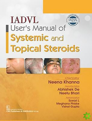 IADVL User's Manual of Systemic and Topical Steroids