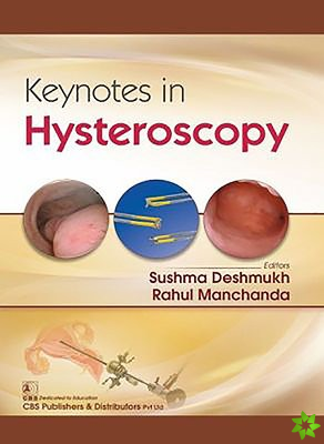 Keynotes in Hysteroscopy