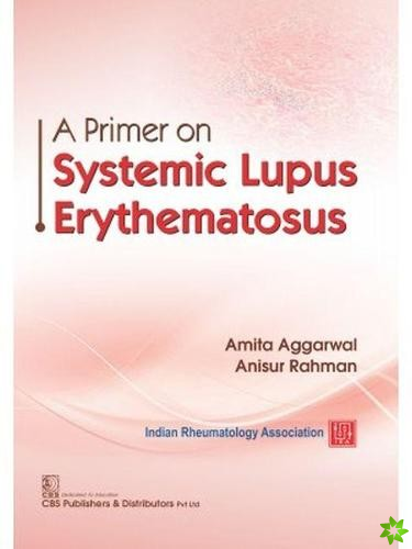 Primer on Systemic Lupus Erythematosus
