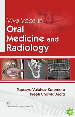 Viva Voce in Oral Medicine and Radiology