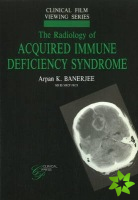 Radiology of Acquired Immune Deficiency Syndrome