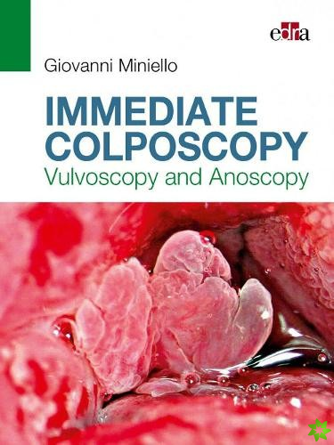 Immediate Colposcopy - Vulvoscopy and Anoscopy