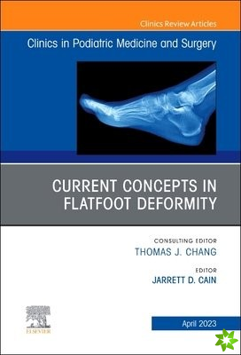 Current Concepts in Flatfoot Deformity , An Issue of Clinics in Podiatric Medicine and Surgery