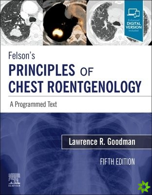 Felson's Principles of Chest Roentgenology, A Programmed Text