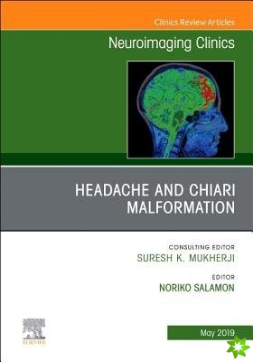 Headache and Chiari Malformation, An Issue of Neuroimaging Clinics of North America