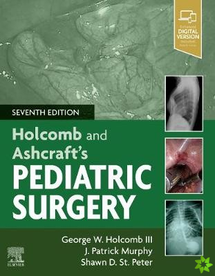 Holcomb and Ashcraft's Pediatric Surgery