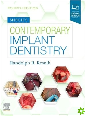 Misch's Contemporary Implant Dentistry
