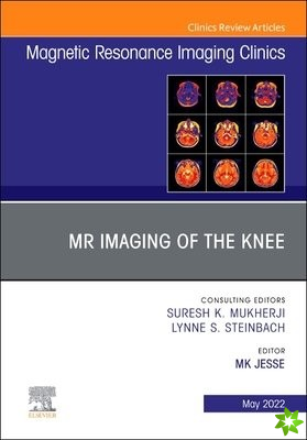 MR Imaging of The Knee, An Issue of Magnetic Resonance Imaging Clinics of North America