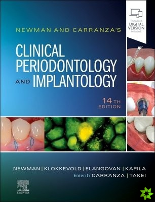Newman and Carranza's Clinical Periodontology and Implantology