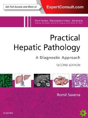 Practical Hepatic Pathology: A Diagnostic Approach