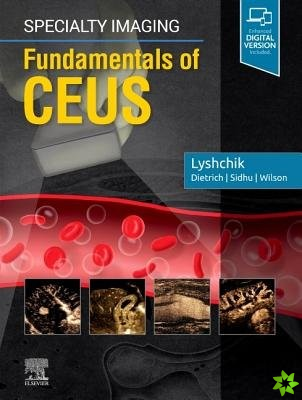 Specialty Imaging: Fundamentals of CEUS