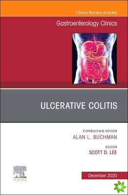 Ulcerative Colitis, An Issue of Gastroenterology Clinics of North America