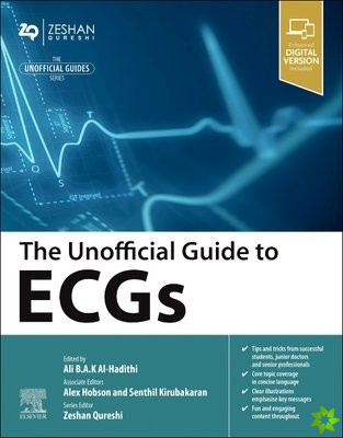 Unofficial Guide to ECGs