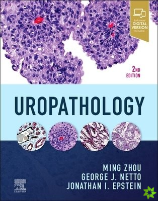 Uropathology