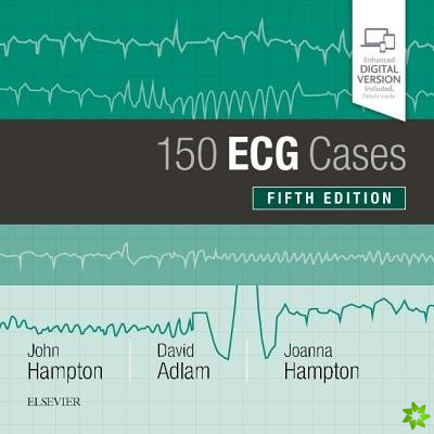 150 ECG Cases
