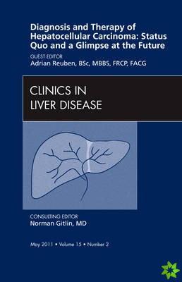 Diagnosis and Therapy of Hepatocellular Carcinoma: Status Quo and a Glimpse at the Future, An Issue of Clinics in Liver Disease