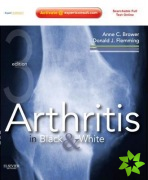 Arthritis in Black and White