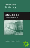 Dental Implants, An Issue of Dental Clinics