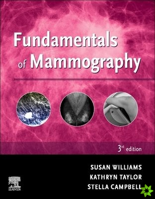 Fundamentals of Mammography