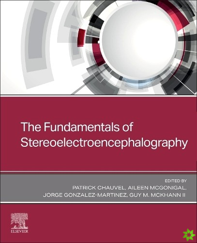 Fundamentals of Stereoelectroencephalography