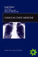 Lung Cancer, An Issue of Clinics in Chest Medicine