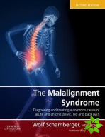 Malalignment Syndrome