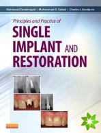 Principles and Practice of Single Implant and Restoration