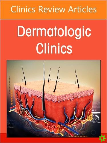 Psoriasis: Contemporary and Future Therapies, An Issue of Dermatologic Clinics