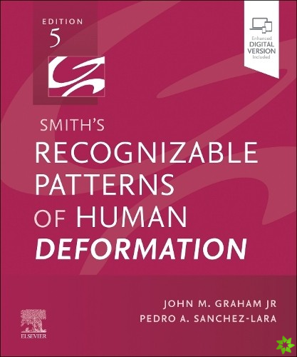 Smith's Recognizable Patterns of Human Deformation