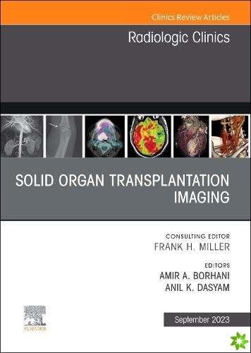 Solid organ transplantation imaging, An Issue of Radiologic Clinics of North America