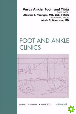 Varus Foot, Ankle, and Tibia, An Issue of Foot and Ankle Clinics