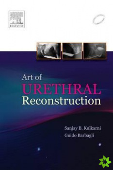 Art of Urethral Reconstruction