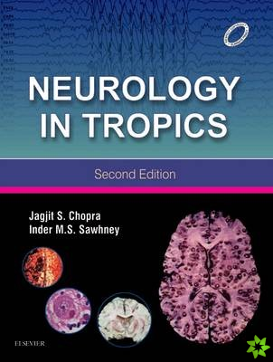 Neurology in Tropics