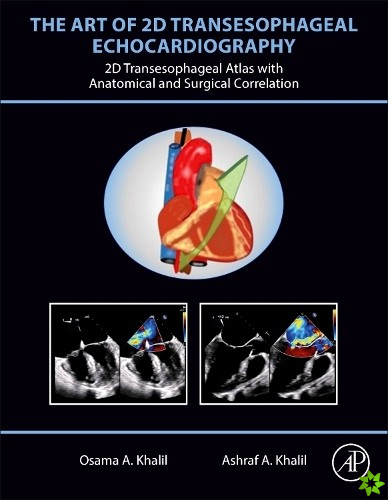 Art of 2D Transesophageal Echocardiography